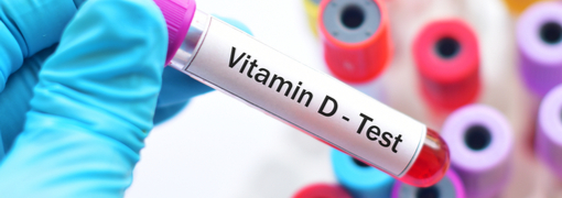 בדיקת ויטמין די ( 25-Hydroxyvitamin D) - תמונה